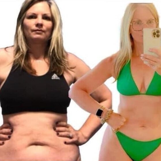 weight-loss-testimonial